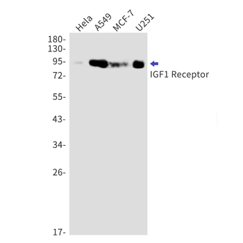 IGF1 Receptor Rabbit Monoclonal Antibody