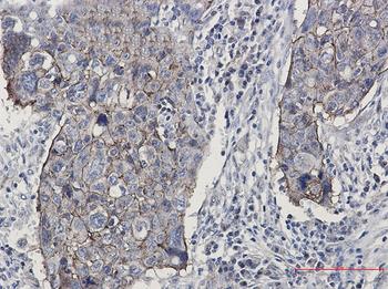 Junctional Adhesion Molecule 1 Rabbit mAb