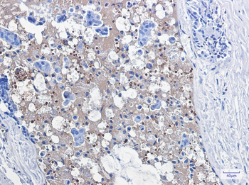Catalase Rabbit mAb