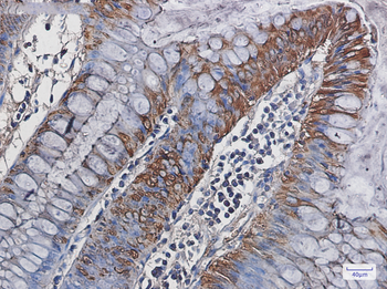 Carbonic Anhydrase 1 Rabbit mAb