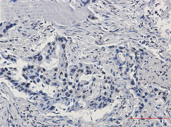 HIF1 beta Rabbit mAb