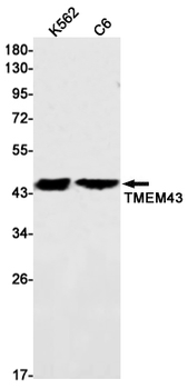 Transmembrane Protein 43 Rabbit mAb