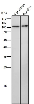 PKD1 Rabbit mAb