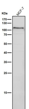 PKD1 Rabbit mAb