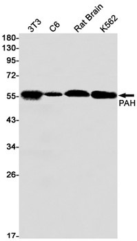 PAH Rabbit Monoclonal Antibody