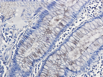 Entactin Rabbit mAb