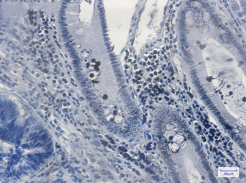 MGMT Rabbit mAb