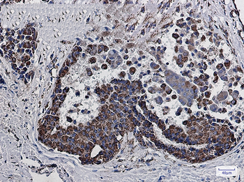 MDH2 Rabbit mAb