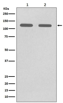 CD146 Rabbit mAb