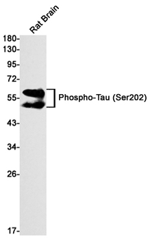 Tau (Phospho-Ser202) Rabbit mAb Antibody
