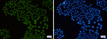 Macro H2A.1 Rabbit mAb
