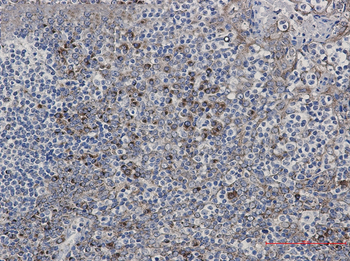 LMAN1 Rabbit mAb