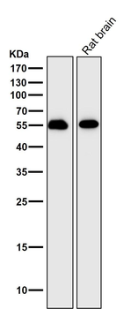 IRF7 Rabbit mAb