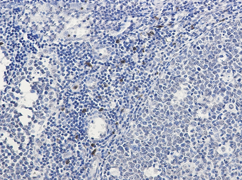 IL 26 Rabbit mAb