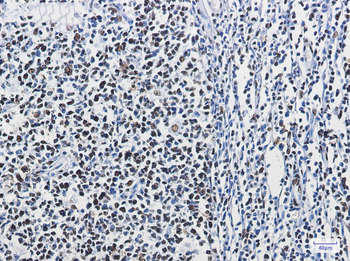 hnRNP M Rabbit mAb