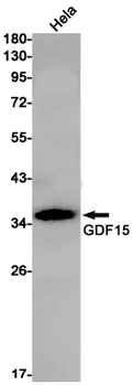 GDF15 Rabbit mAb Antibody