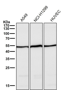 Angiopoietin 2 Rabbit mAb