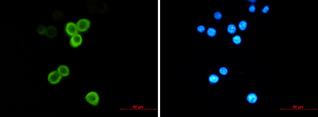 Anterior Gradient 2 Rabbit mAb