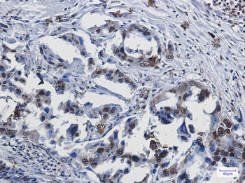 SUMO1 Rabbit mAb