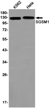 SGSM1 Rabbit mAb
