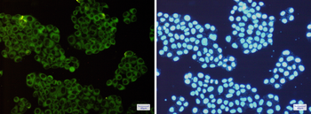 ROCK2 Rabbit mAb