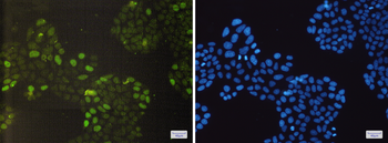 Rb Rabbit mAb