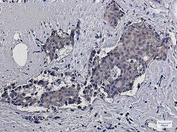 RACK1 Rabbit mAb