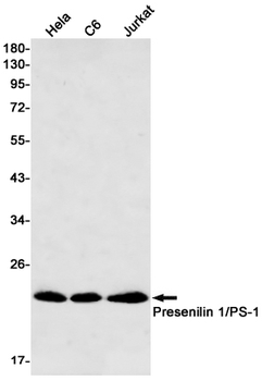 Presenilin 1 Rabbit mAb Antibody