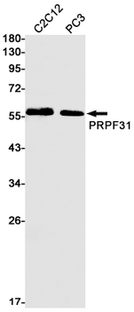 PRPF31 Rabbit mAb
