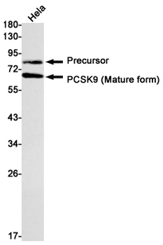 PCSK9 Rabbit mAb Antibody
