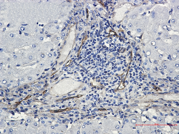 ORAI3 Rabbit mAb