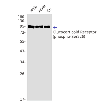 Phospho-Glucocorticoid Receptor (Ser226) Rabbit mAb
