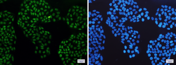 Glucocorticoid Receptor Rabbit mAb