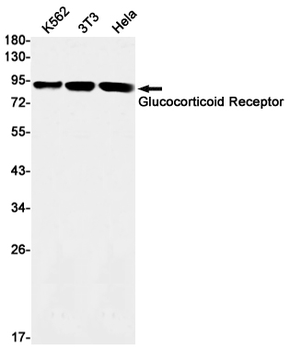 Glucocorticoid Receptor Rabbit mAb
