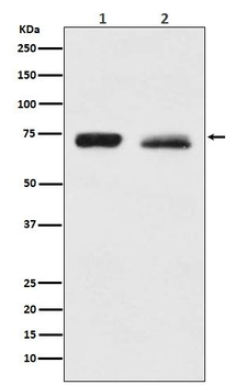 NF2 Rabbit mAb Antibody