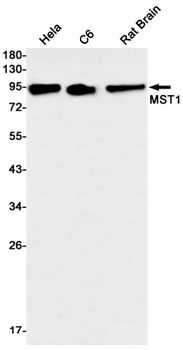 MST1 Rabbit mAb