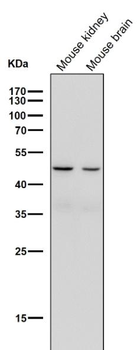 Legumain Rabbit mAb