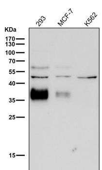 Legumain Rabbit mAb