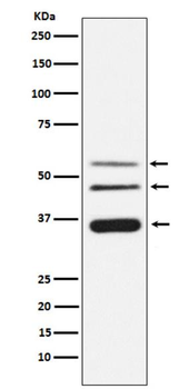 Legumain Rabbit mAb