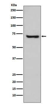 HspA2 Rabbit mAb