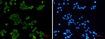 Tyrosine Protein Kinase HCK Rabbit mAb