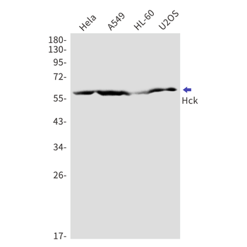 Tyrosine Protein Kinase HCK Rabbit mAb