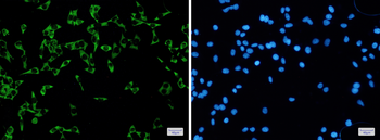 FMRP Rabbit mAb