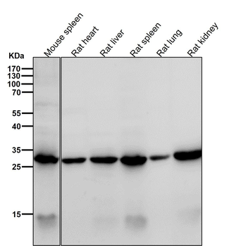 KGF Rabbit mAb