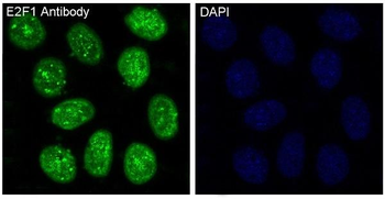 E2F1 Rabbit mAb