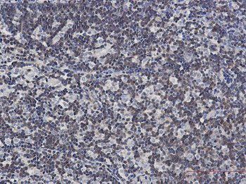 DGKA Rabbit mAb