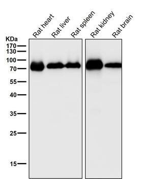 Cytochrome P450 1B1 Rabbit mAb