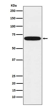 Cytochrome P450 1B1 Rabbit mAb