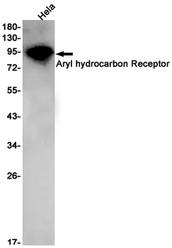 Aryl Hydrocarbon Receptor Rabbit mAb