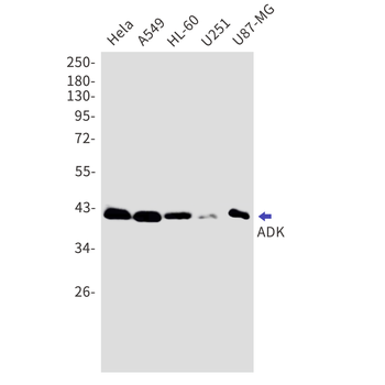 ADK Rabbit mAb